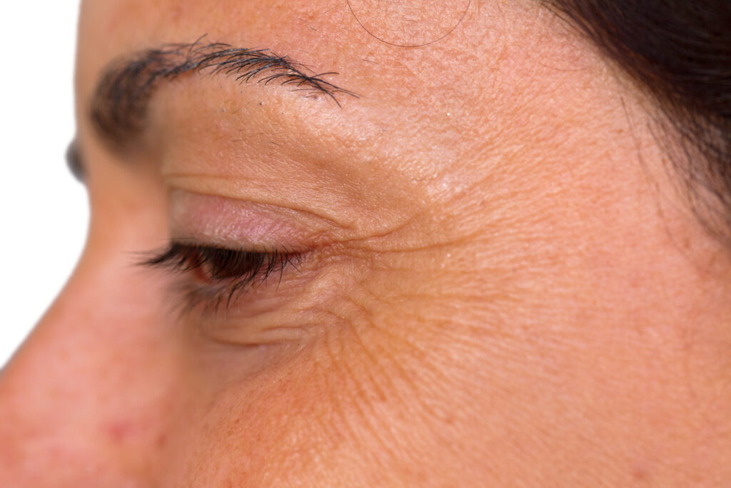 How To Use Essential Oils For The Treatment Of Wrinkles Present Around The Eyes? Essential Oil Benefits