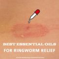 Essential oils for ringworm