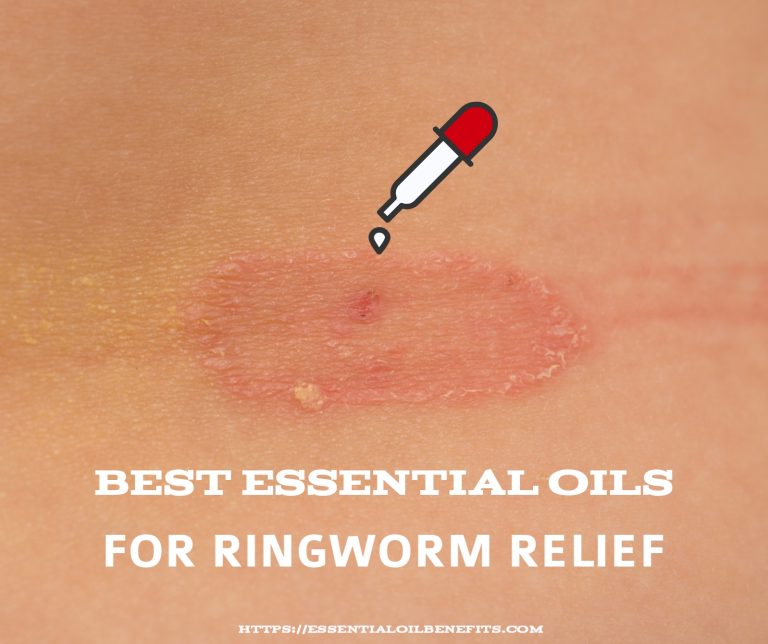 Best Essential Oils and Essential Oil Recipes For Ringworm | Essential ...