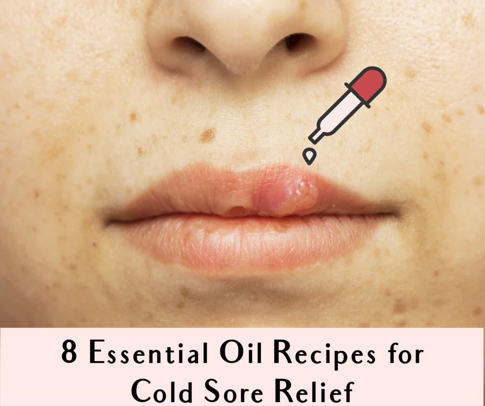 essential oils for cold sores