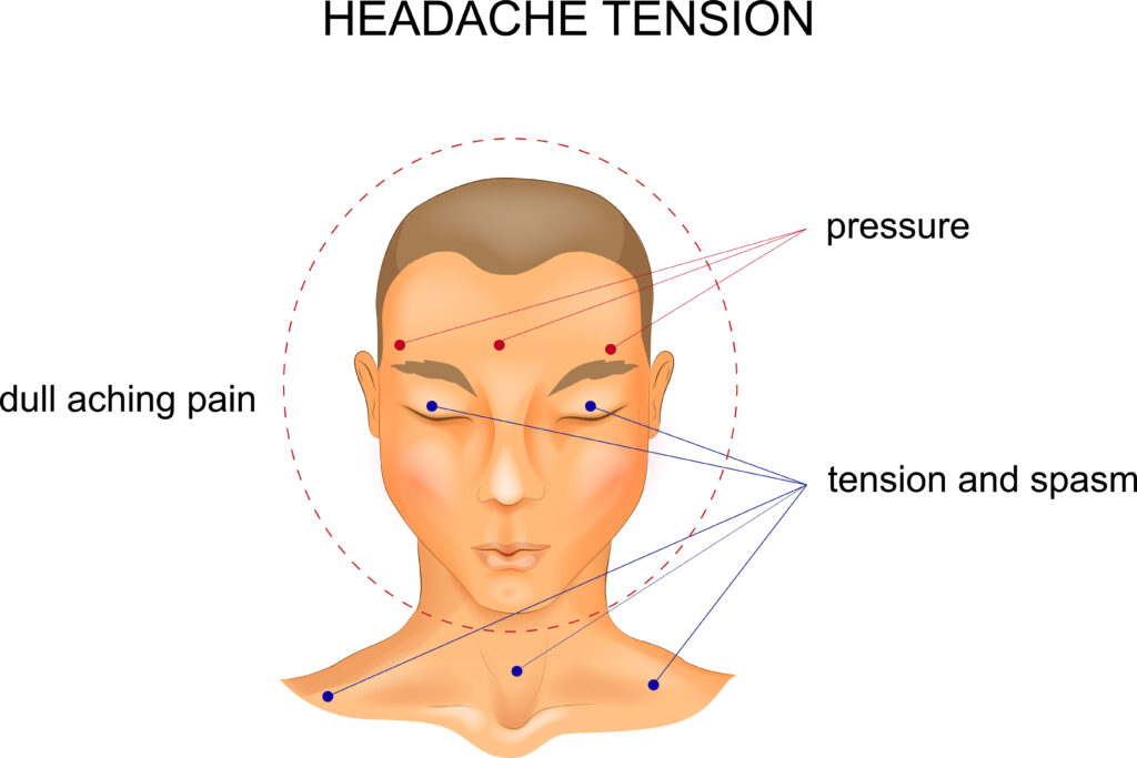 Meilleures recettes d'huile essentielle pour les maux de tête de tension Avantages de l'huile essentielle