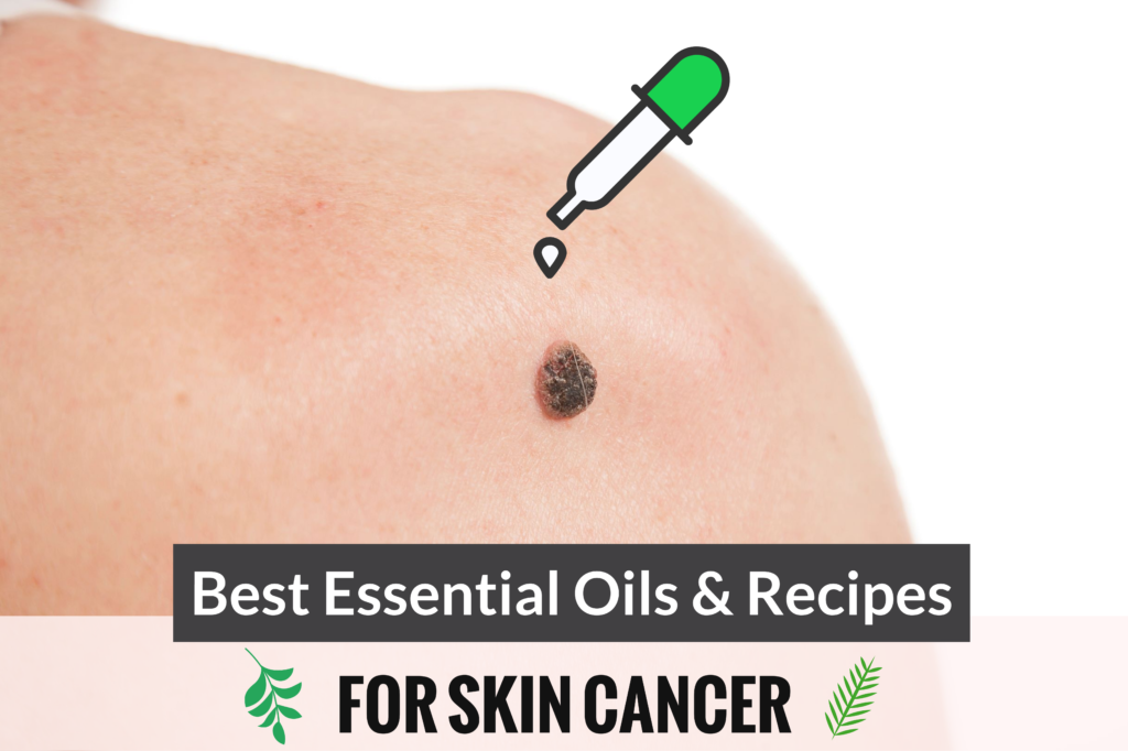 What Are The Best Essential Oils And Recipes For Skin Cancer? Essential Oil Benefits