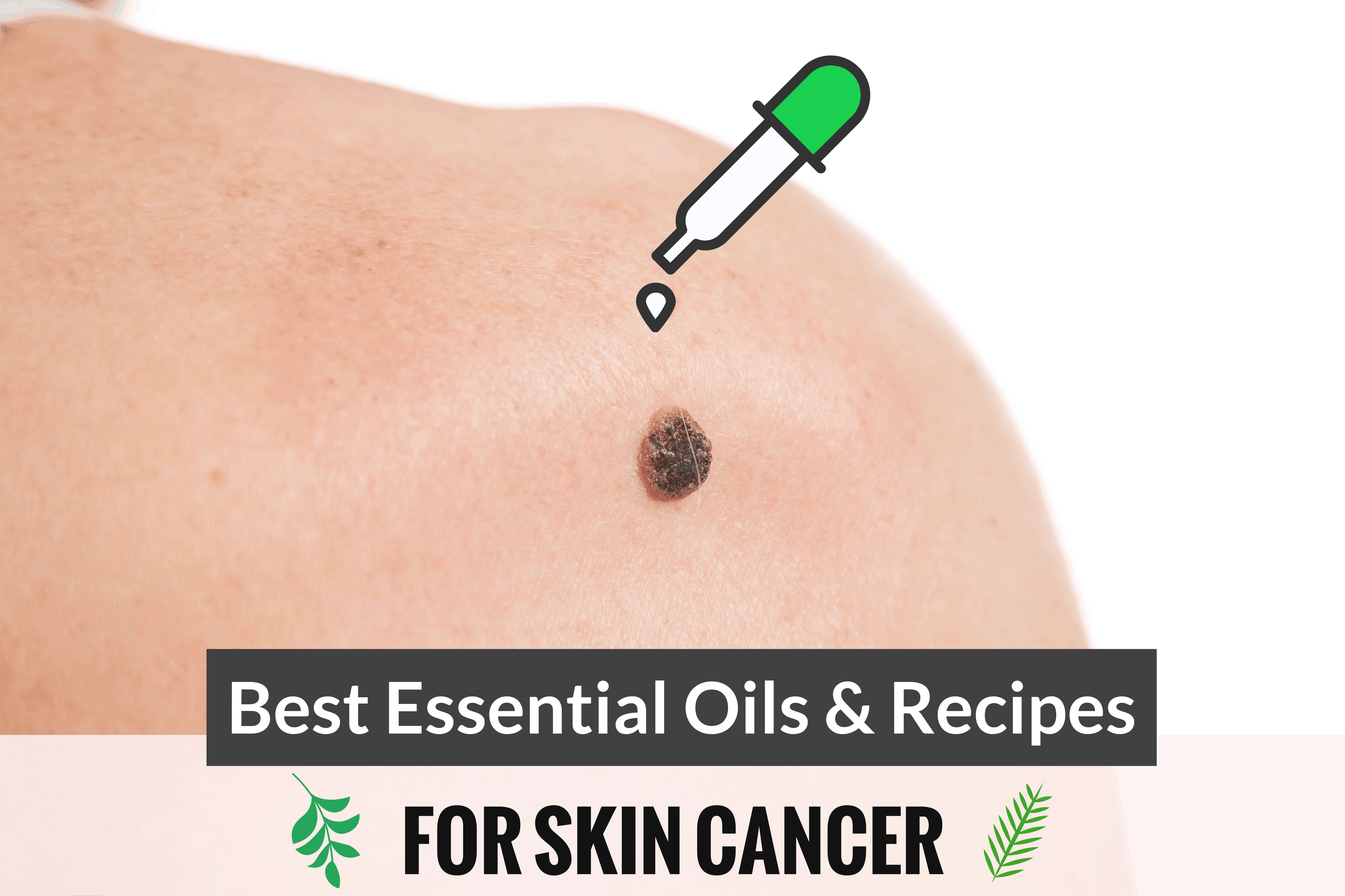 best essential oils for skin cancer
