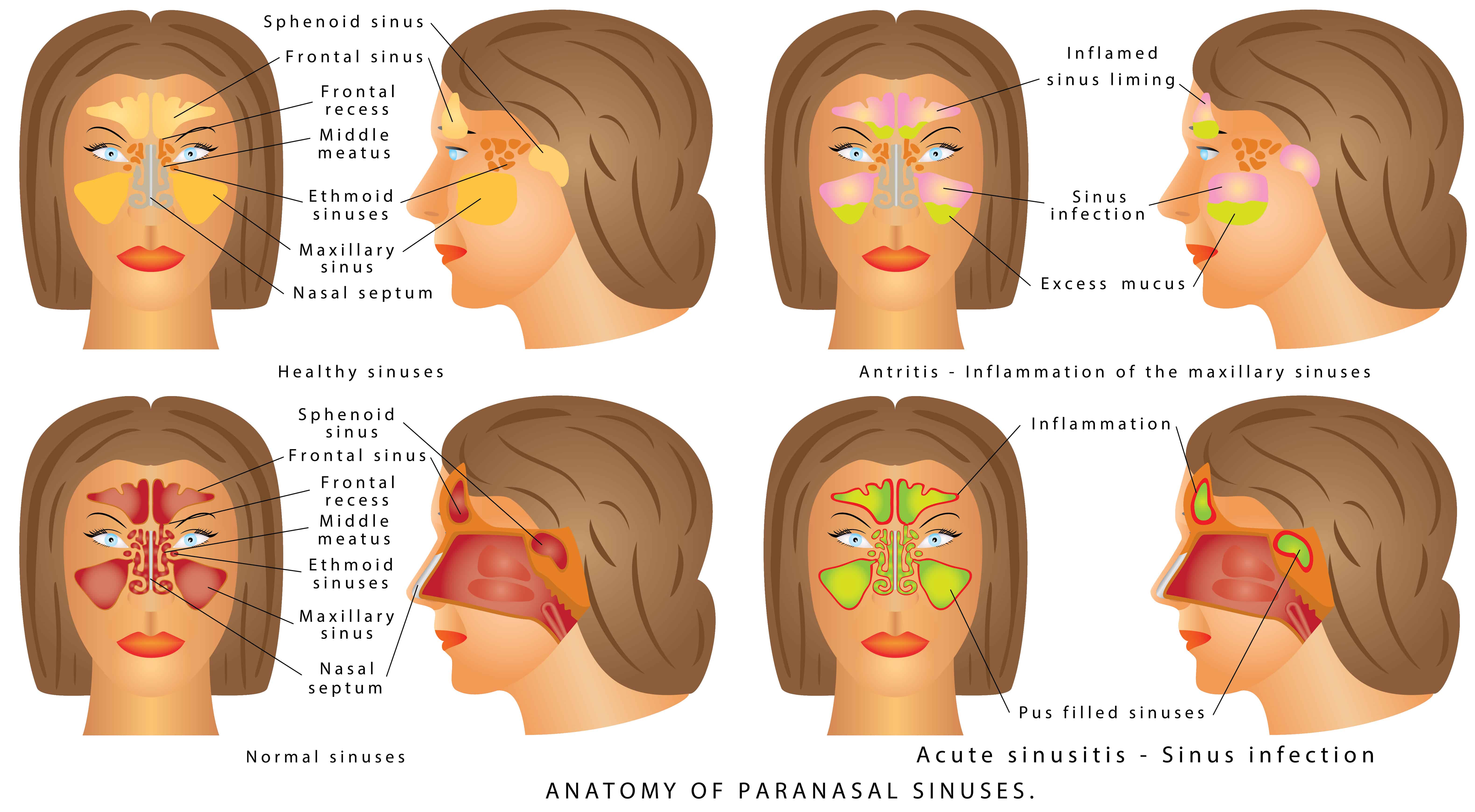 7 façons d'utiliser les huiles essentielles pour soulager la congestion des sinus, les maux de tête et les infections Avantages des huiles essentielles