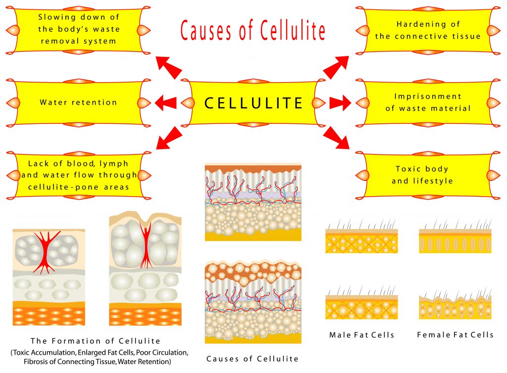 What Are The Best Essential Oils That Treat, Reduce And Remove Cellulite Essential Oil Benefits