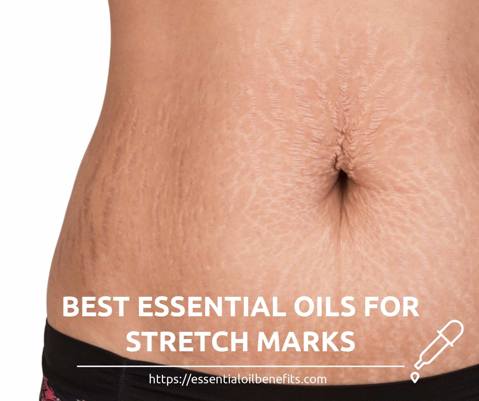 essential oils for stretch marks