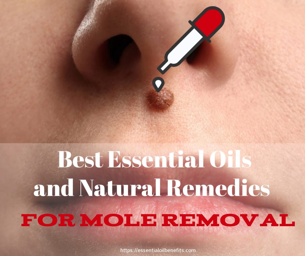 Top 10 Essential Oils and Natural Remedies For Mole Removal Essential Oil Benefits