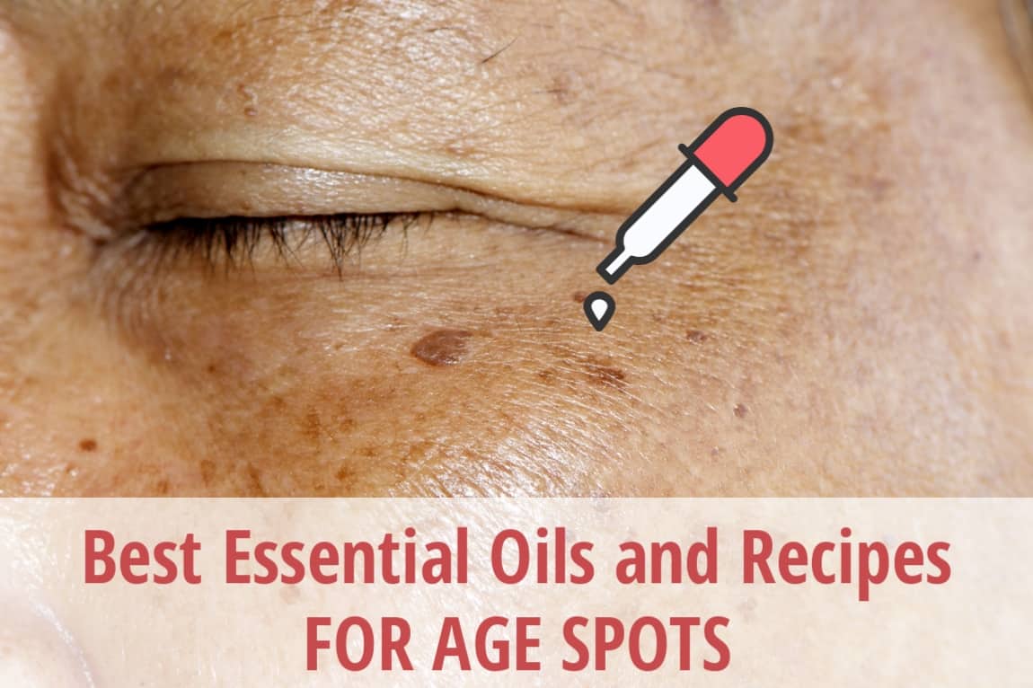 essential oils for age spot
