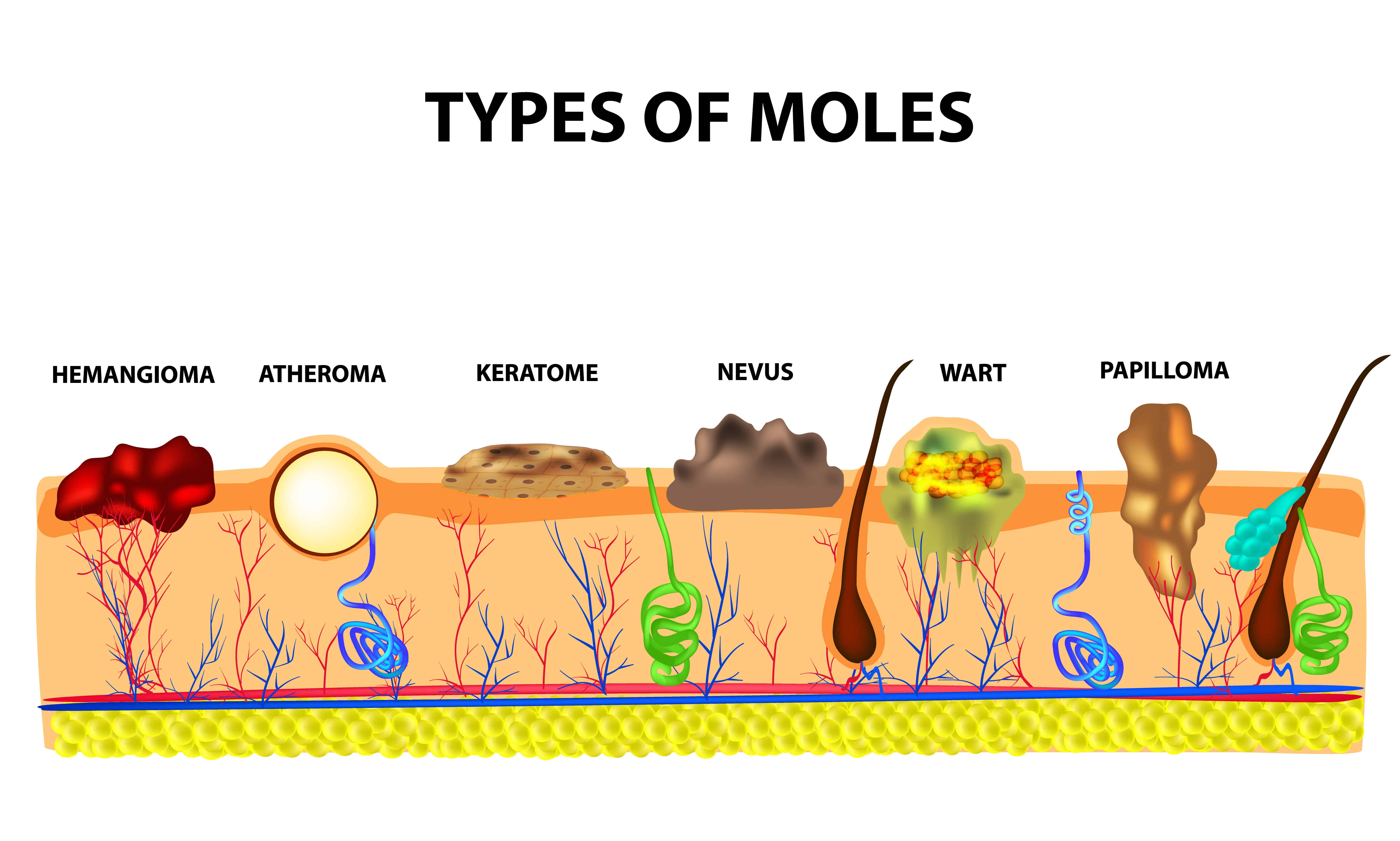 Skin Mole Roots