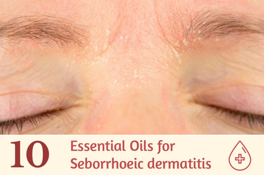 10 Essential Oils for Seborrheic Dermatitis | Essential Oil Benefits