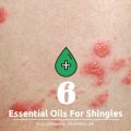 essential oils for shingles
