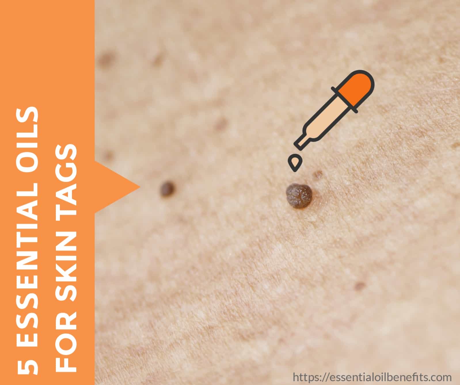 essential oils for skin tags