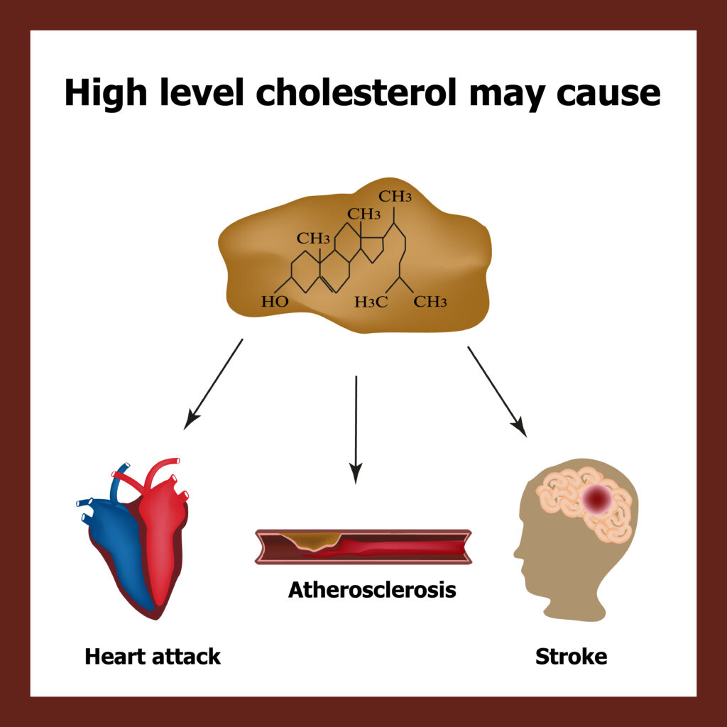 Best Foods & Essential Oils To Lower Cholesterol Naturally | Essential