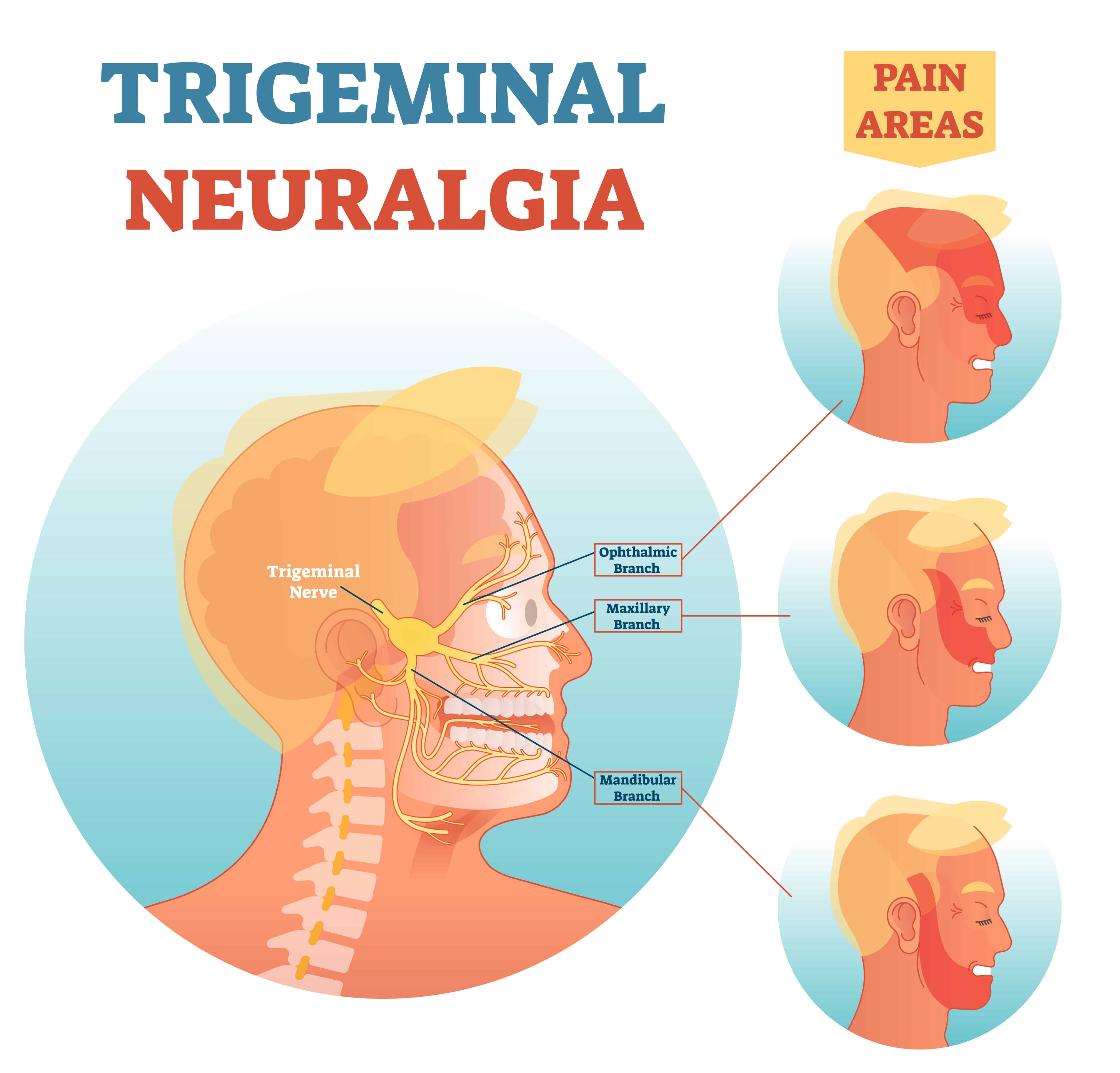 Trigeminal Nerve Chart