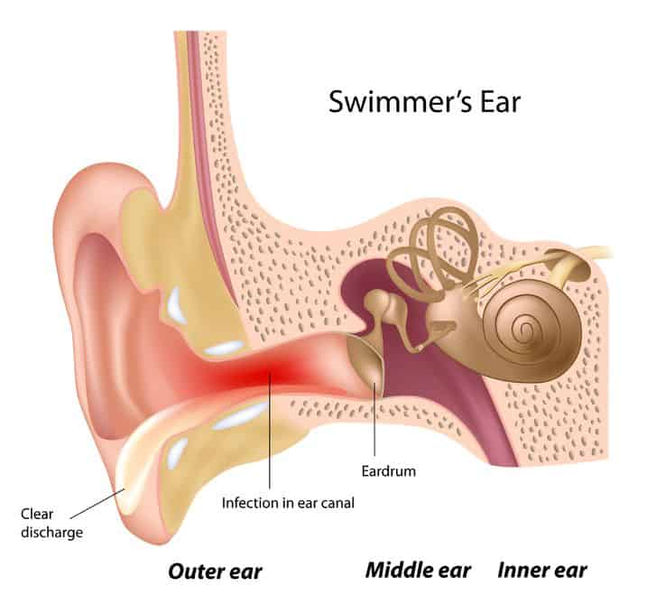 severe insomnia inner ear pain