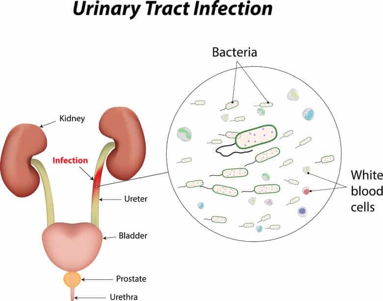 Essential Oils For Urinary Tract Infection: Your Secret Weapon For UTI Treatment And Prevention Essential Oil Benefits