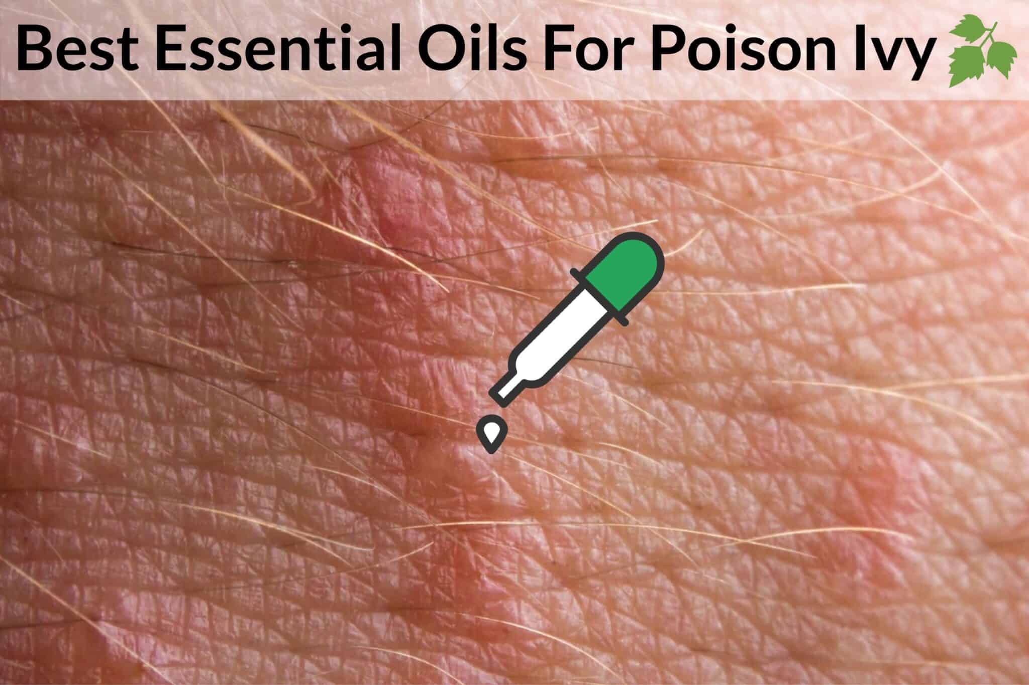 How To Use Essential Oils To Get Rid Of Poison Ivy 7 Essential Oils 
