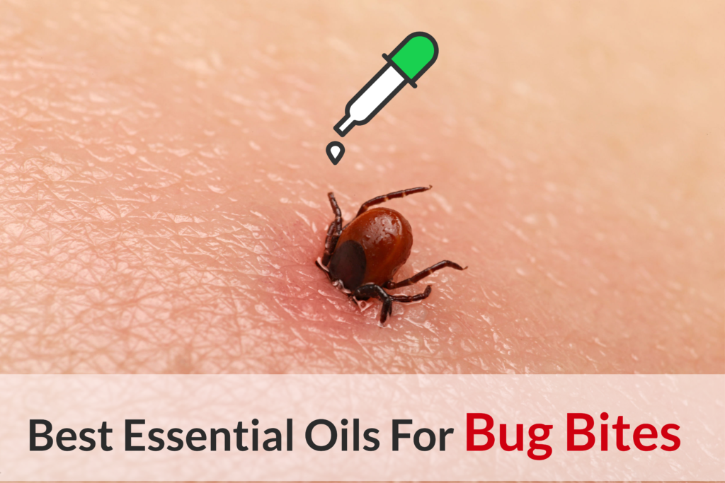 What Bit Me: The Ultimate Guide About Essential Oils For Bug Bites Essential Oil Benefits