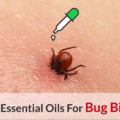 best essential oils for bug bite