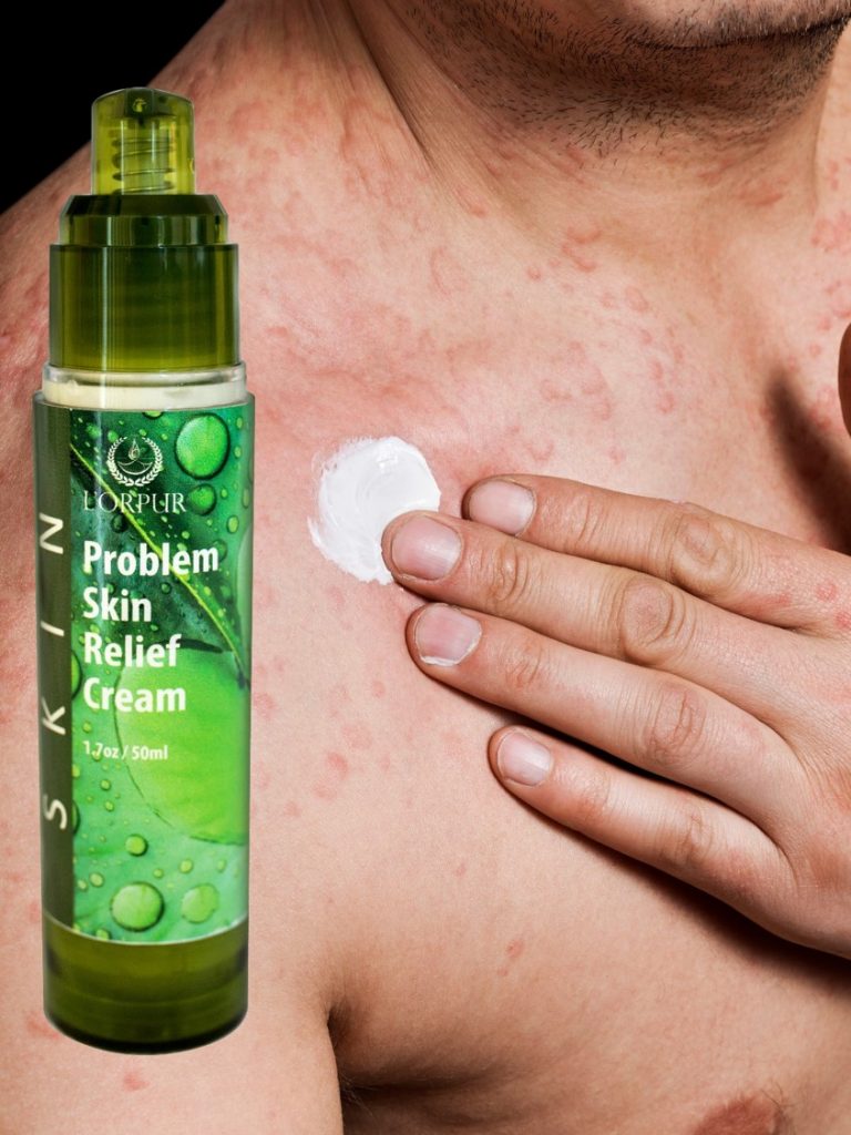 Skin Rashes? Let Essential Oils Handle Those Nasty Eruptions! Essential Oil Benefits