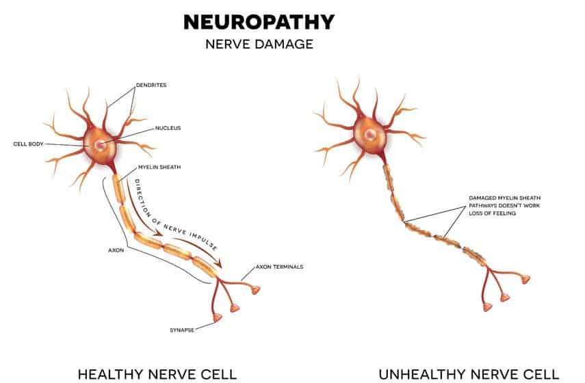 Essential Oils For Neuropathy: Everything You Need To Know For Neuropathic Pain Treatment Essential Oil Benefits