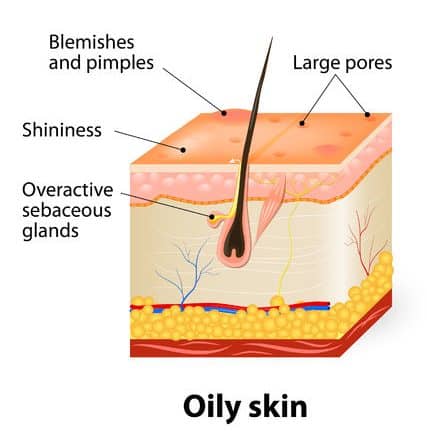 If You Don’t Know Your Skin Type, All Skincare Products Can Be Dangerous! Essential Oil Benefits