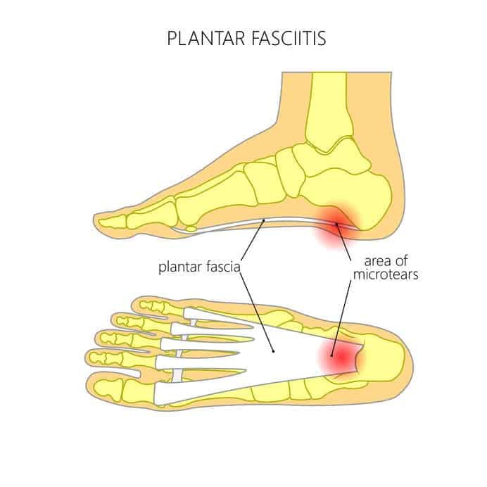 Essential Oils For Feet: Sorting Out All Your Foot Problems In One Natural, Fell Swoop Essential Oil Benefits