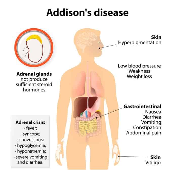 Essential Oils For Adrenal Fatigue: When Your Battery Needs More Go Juice Essential Oil Benefits