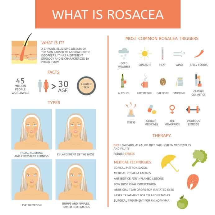 Want To Keep Your Rosacea Redness, Dryness And Inflammation Under Control? Try This Skincare Routine! Essential Oil Benefits