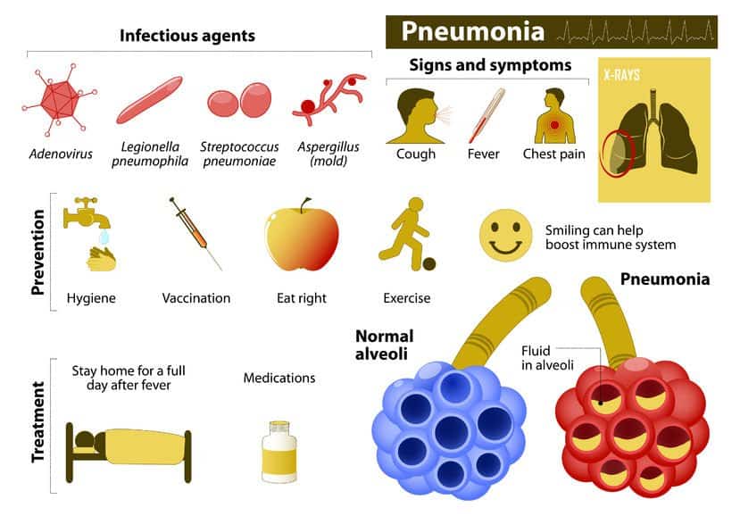 Essential Oils For Pneumonia: For When You Really Need A Sigh Of Relief Essential Oil Benefits