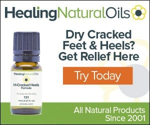 Essential Oils For Cracked Heels: When Achilles Got Nothing On You Essential Oil Benefits