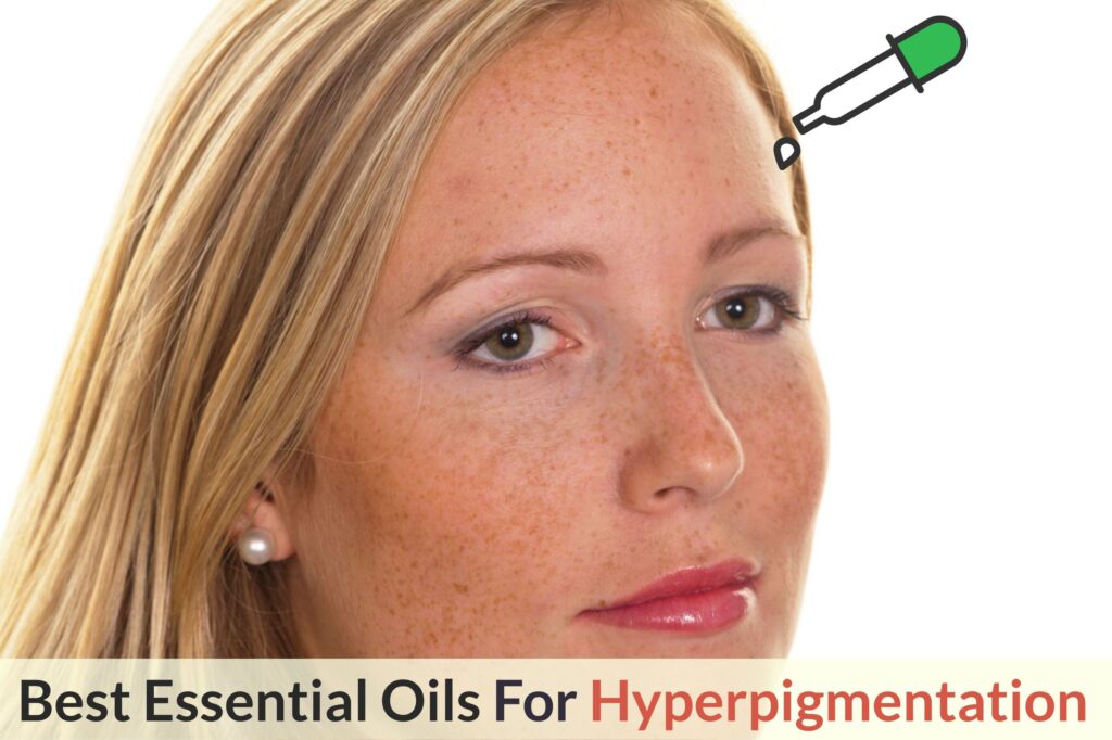 What Are The Best Essential Oils And Recipes For Hyperpigmentation: A Ray Of Light From Mother Nature To Lighten Your Skin! Essential Oil Benefits