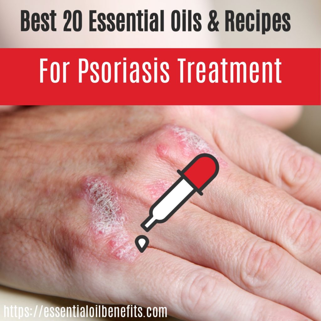 What Are The Best Essential Oils for Psoriasis And What Is The Best ...