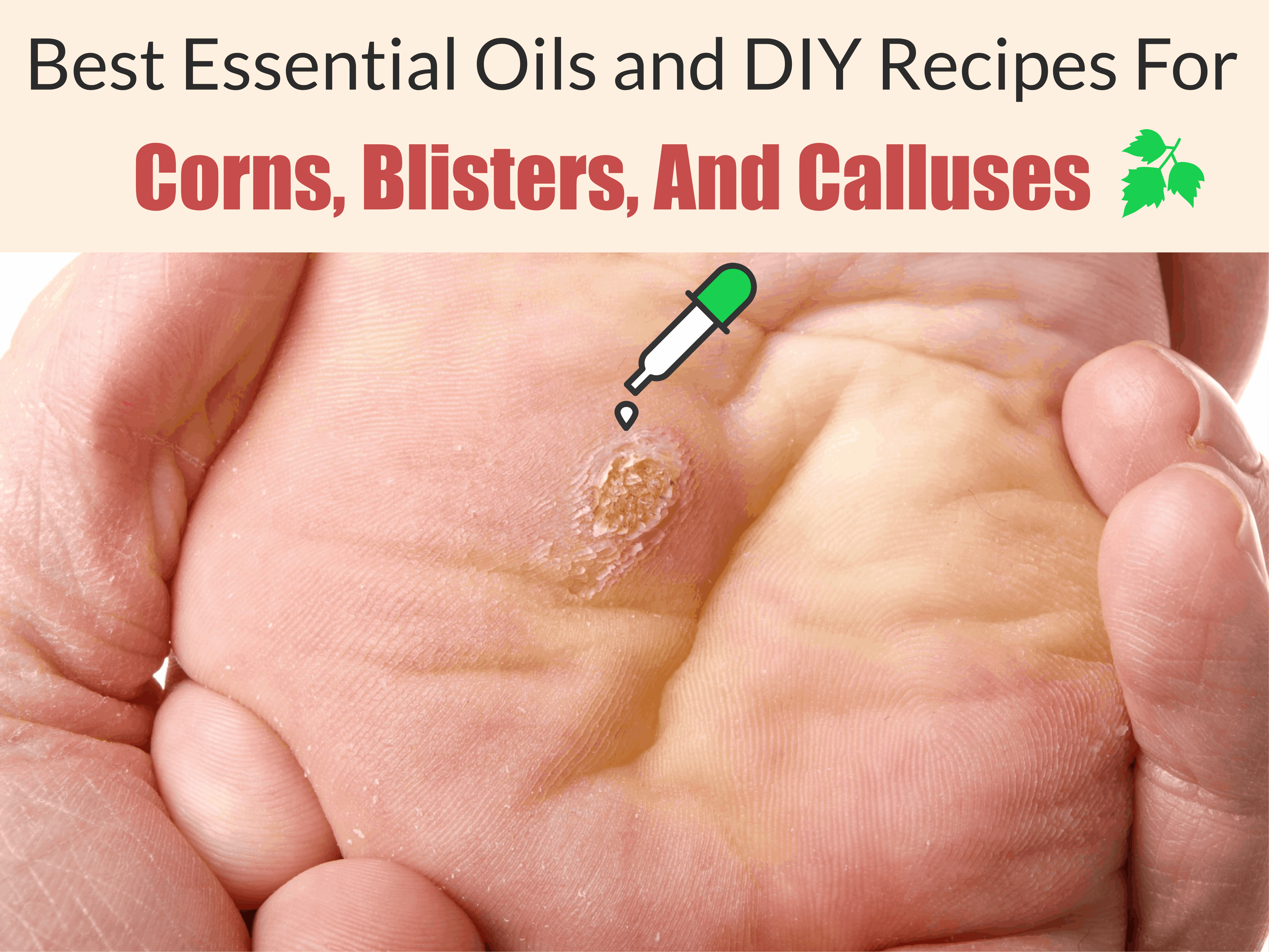 essential oils for callus