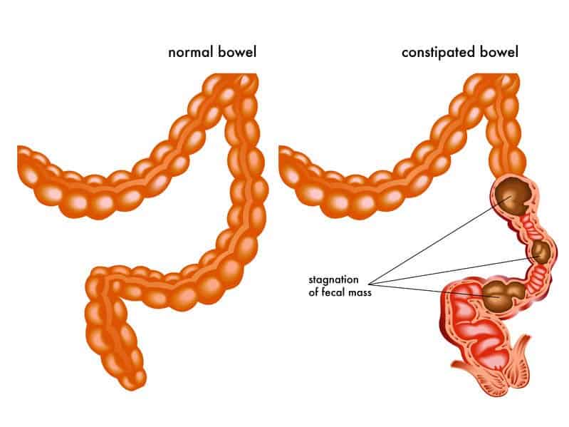 Essential Oils For Constipation: When Huffing And Grunting Won’t Work Essential Oil Benefits