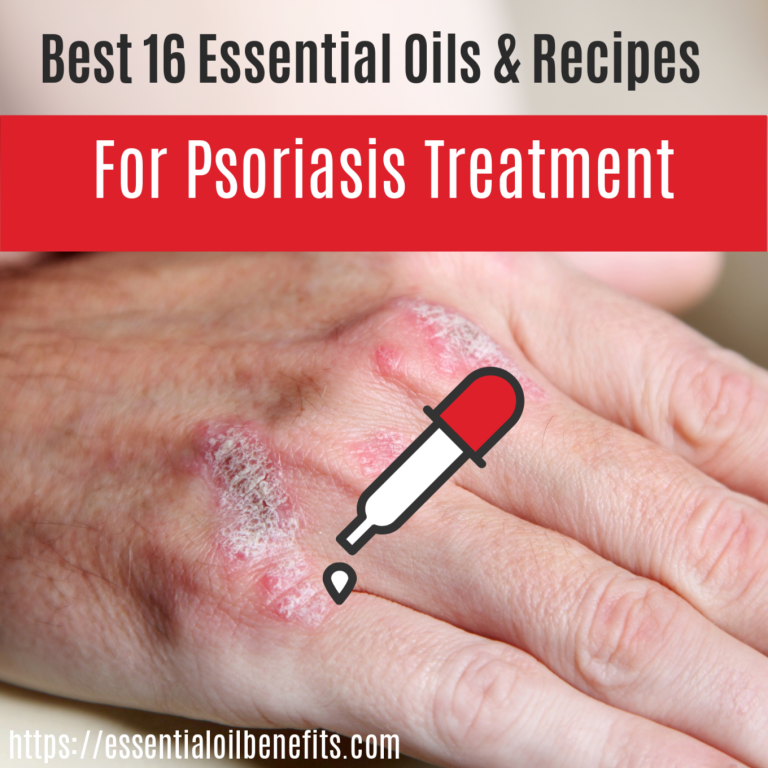 What Are The Best Essential oils For Scalp Psoriasis Essential Oil