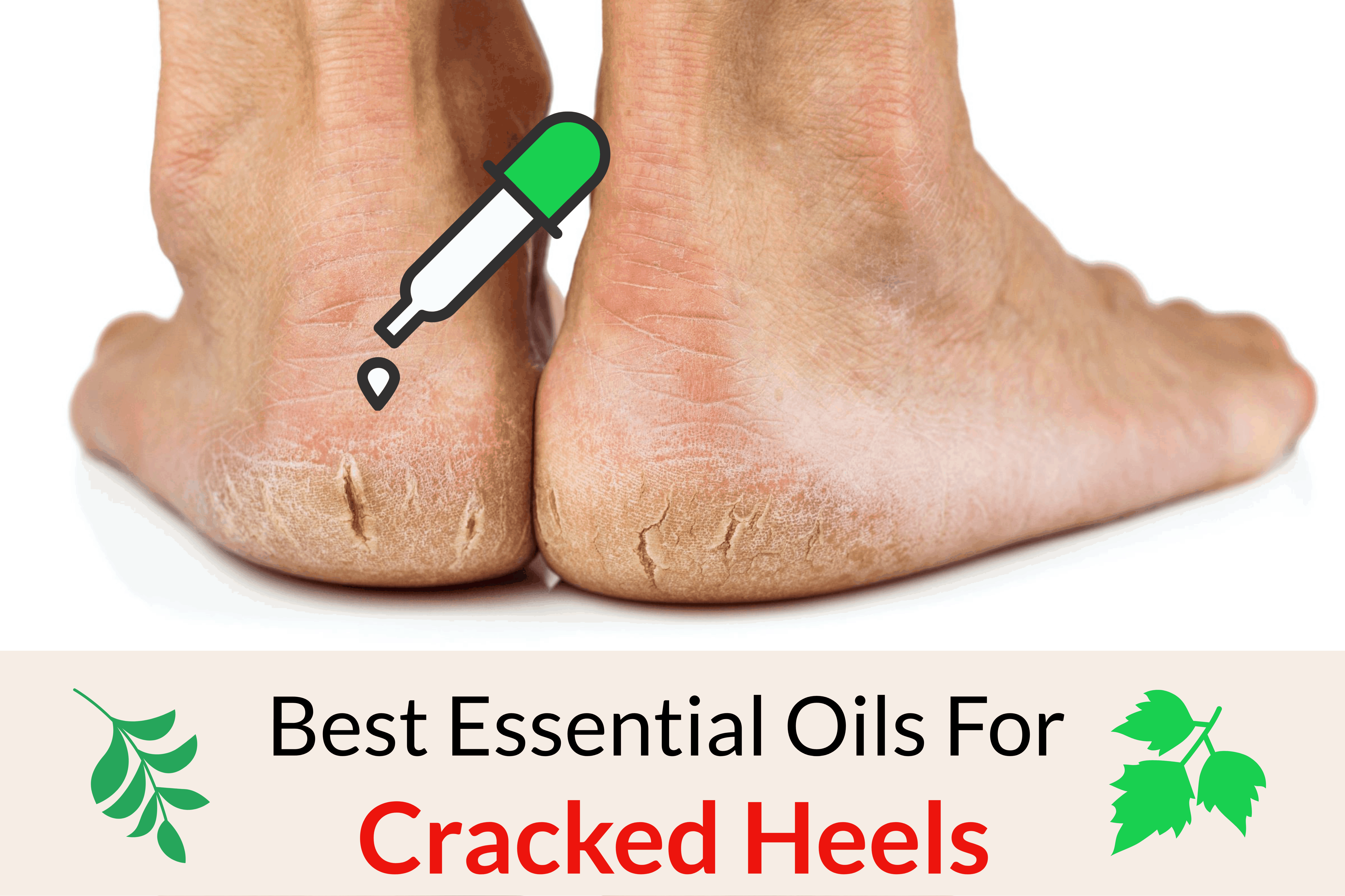 best essential oils for cracked heels
