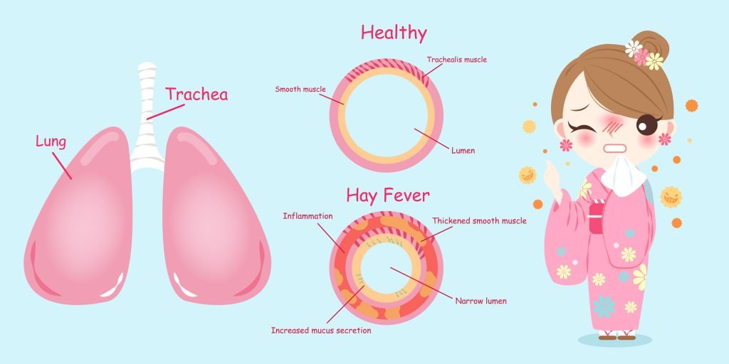 Essential Oils For Hay Fever: And No, It’s Not What You Get When You Smoke Too Much Grass Essential Oil Benefits