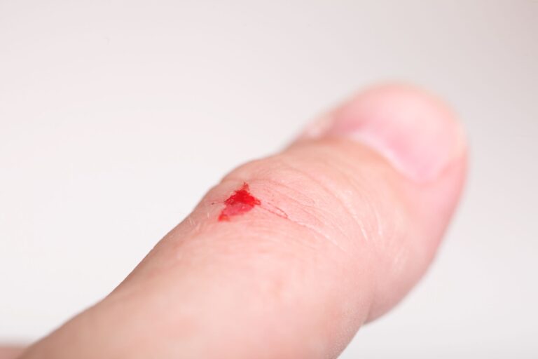 Best Essential Oils for Cuts