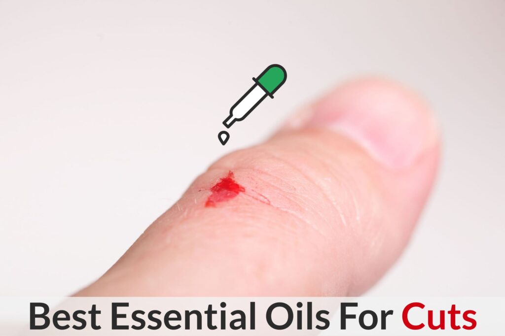 Have A Cut? Cut The Bleeding, Pain, Inflammation And Scarring With Essential Oils! Essential Oil Benefits