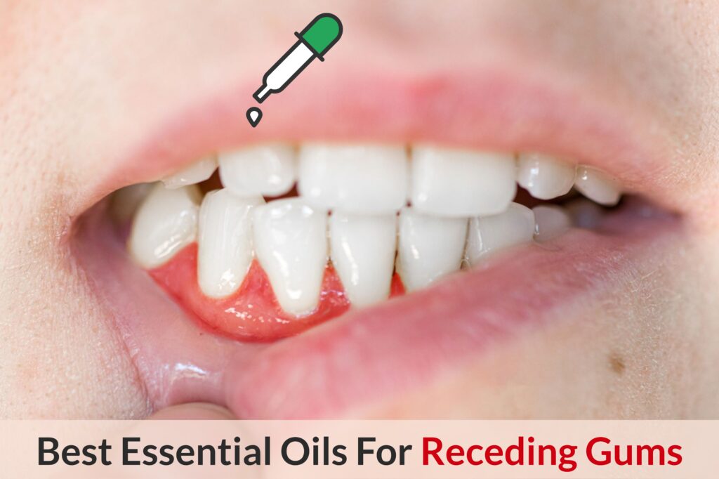 Essential Oil For Receding Gums - Brighten Up Someone’s Day With A Healthy Smile Essential Oil Benefits