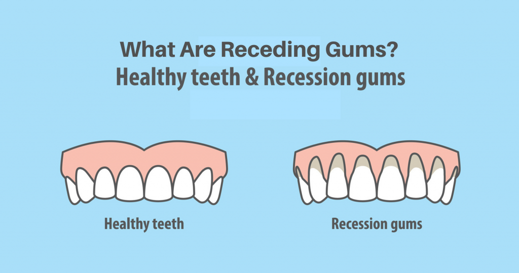 Essential Oil For Receding Gums - Brighten Up Someone’s Day With A Healthy Smile Essential Oil Benefits