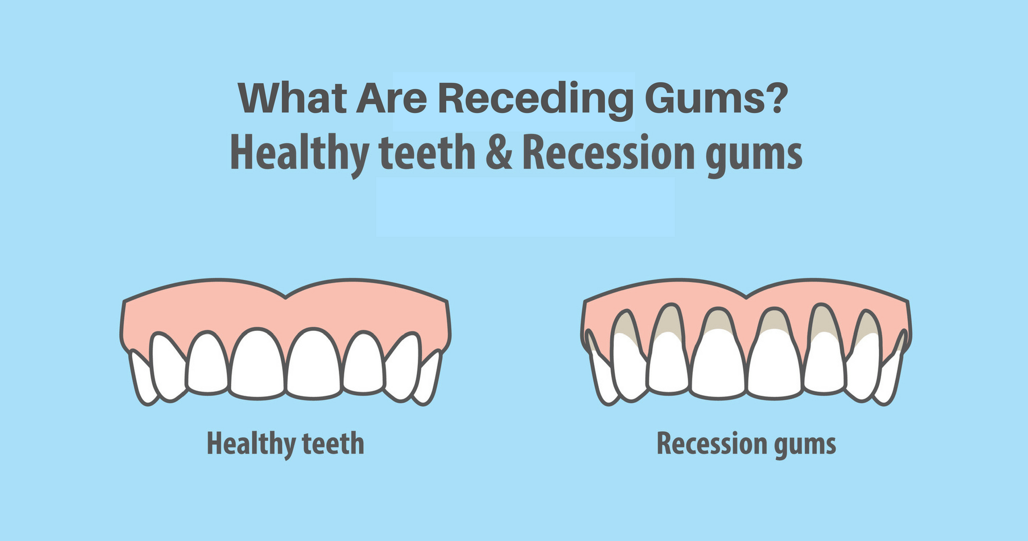 Essential Oil For Receding Gums Brighten Up Someone’s Day With A