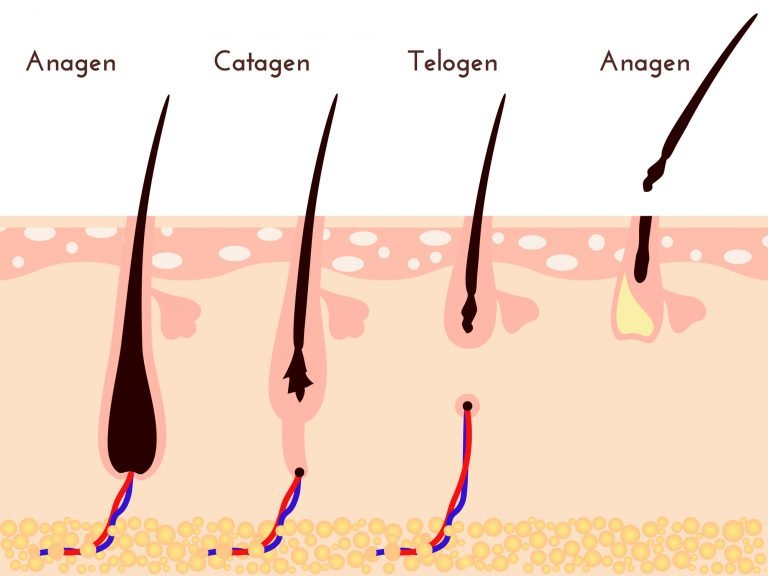 No Pull, No Pain Ways To Get Rid Of Facial Hair (Hirsutism): Essential ...