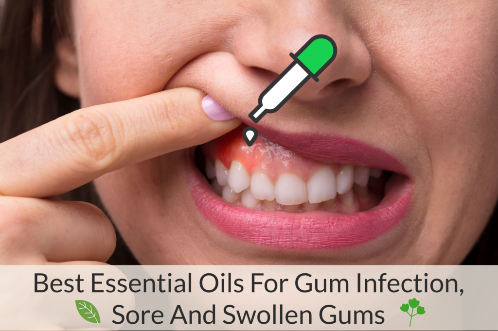 Best Essential Oils For Gum Infection, Sore And Swollen Gums Essential Oil Benefits