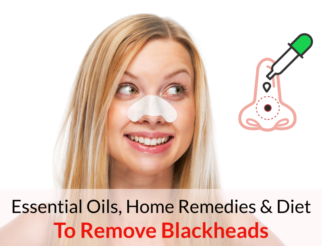 Essential Oils, Home Remedies & Diet To Get Rid Of Blackheads Essential Oil Benefits