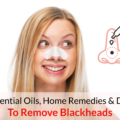 best essential oils for blackheads