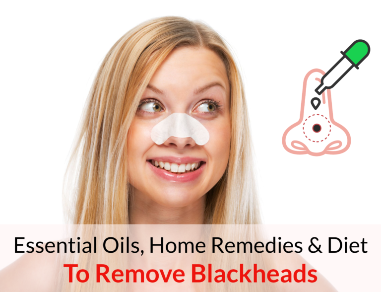 best essential oils for blackheads