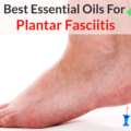 essential oils for plantar fasciitis