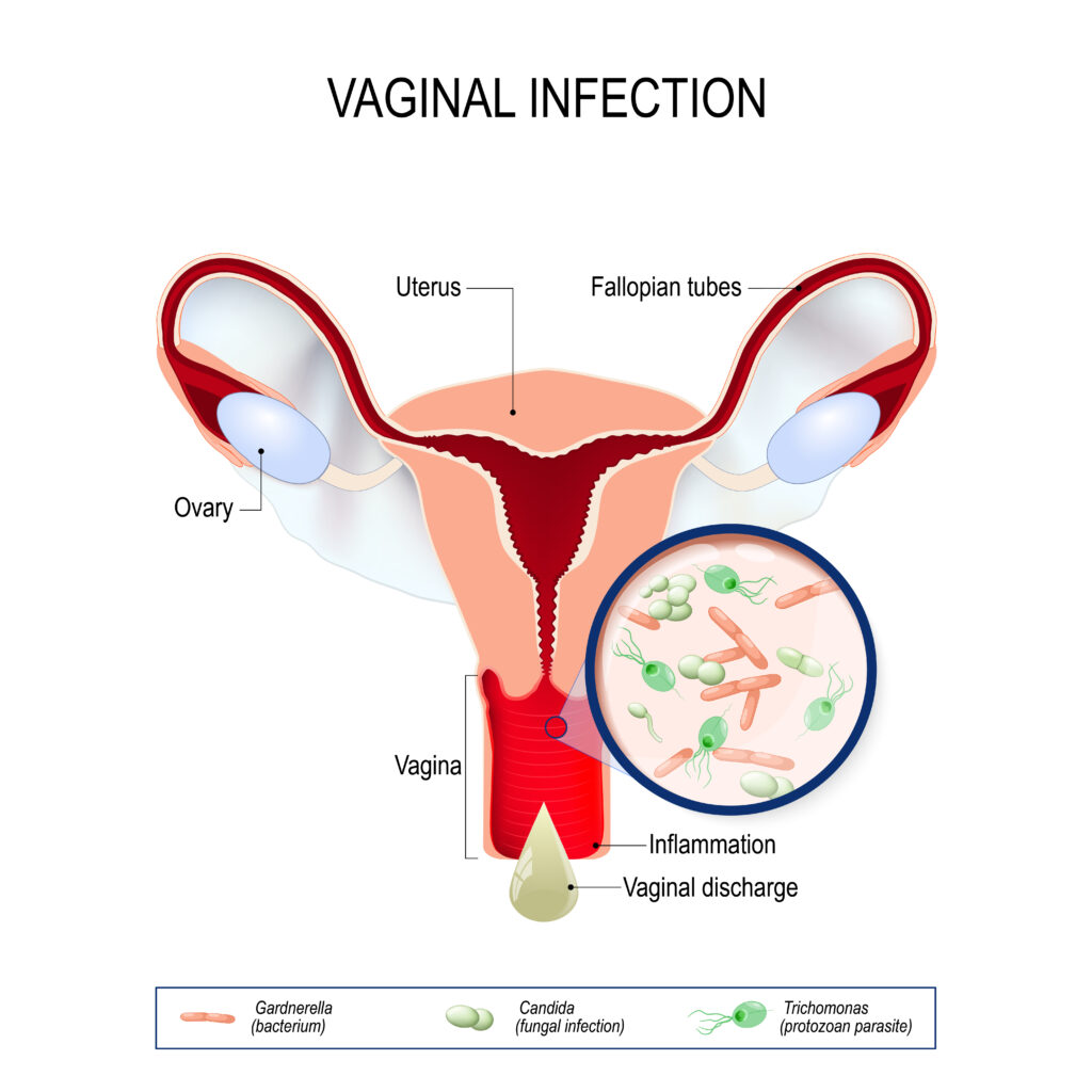 How To Tame Vaginal Itching With Essential Oils? Essential Oil Benefits
